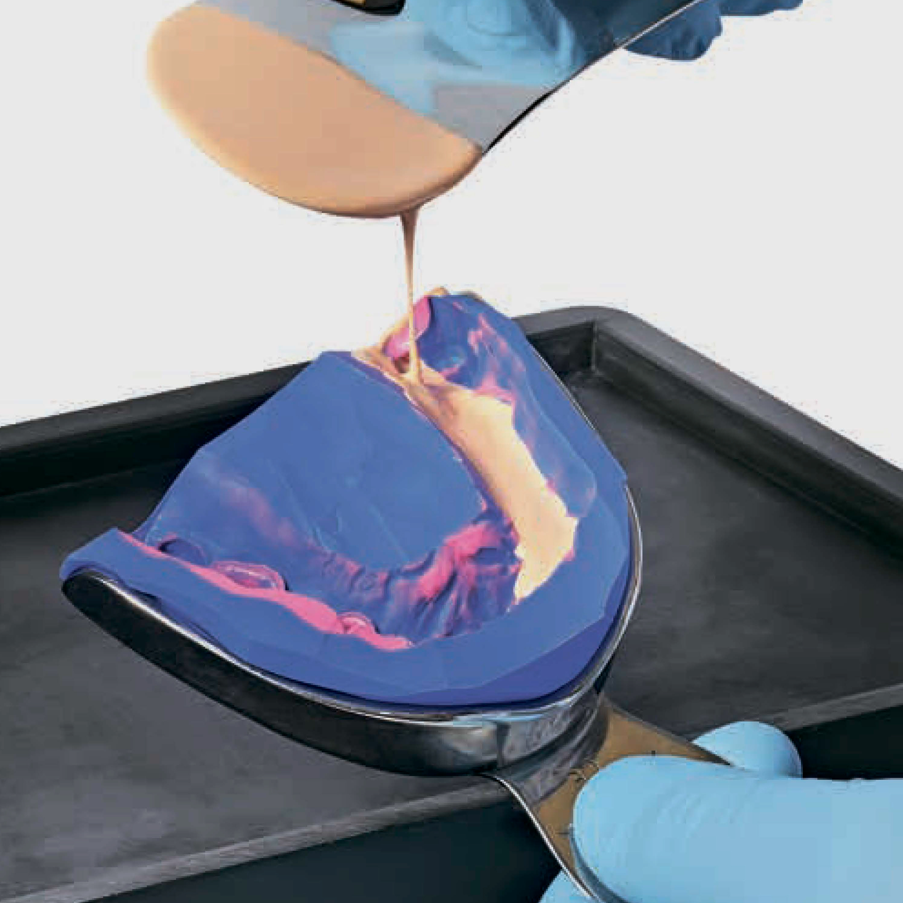 Внесение гипса в оттиск